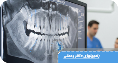 عکس رادیولوژی دندان عقل چه زمانی لازم است؟ | پانورکس و CBCT در لاهیجان