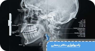 عکس سفالومتری چیست؟ کاربرد، انجام و نقش سفالومتری در درمان ارتودنسی | دکتر آزاده رحمتی لاهیجان